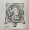 MAURICEAU (François). Traité des maladies des femmes grosses et de celles qui sont nouvellement accouchées, enseignant la bonne et véritable méthode pour bien aider les femmes et leurs accouchements naturels, et les moyens de remédier à tous ceux qui sont contre-nature, et aux indispositions des enfans nouveaux-nés; avec une description tres exacte de toutes les parties de la femme qui servent à la generation : le tout accompagné de plusieurs belles figures en taille daouce, nouvellement et fort correctement gravées