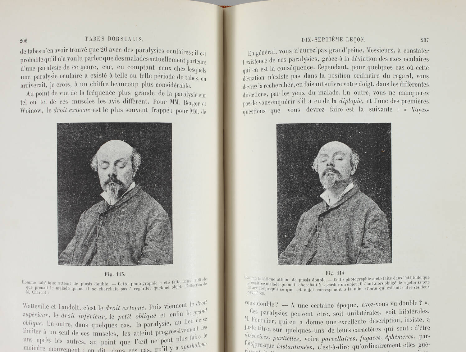 [Neurologie] Pierre MARIE - Leçons sur les maladies de la moelle - 1892 - Photo 2, livre rare du XIXe siècle