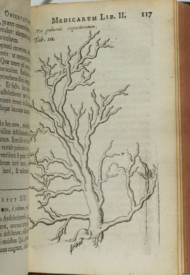 [Médecine] Nicolai Tulp - Observationes Medicae - 1739 - figures - Photo 5, livre ancien du XVIIIe siècle