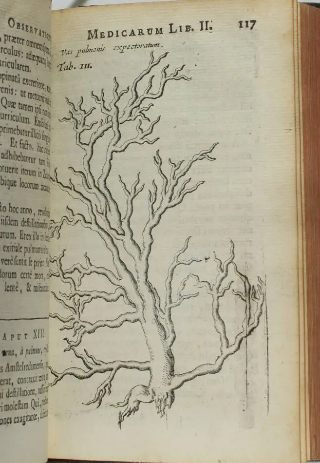 [Médecine] Nicolai Tulp - Observationes Medicae - 1739 - figures - Photo 5, livre ancien du XVIIIe siècle