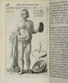 [Médecine] Nicolai Tulp - Observationes Medicae - 1739 - figures - Photo 6, livre ancien du XVIIIe siècle