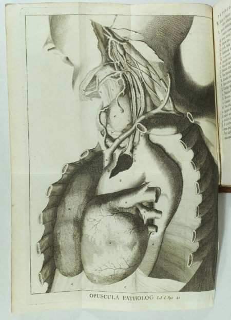 HALLER Opuscula Pathologica - Lausanne, 1755 - EO - Planches - Photo 0, livre ancien du XVIIIe siècle