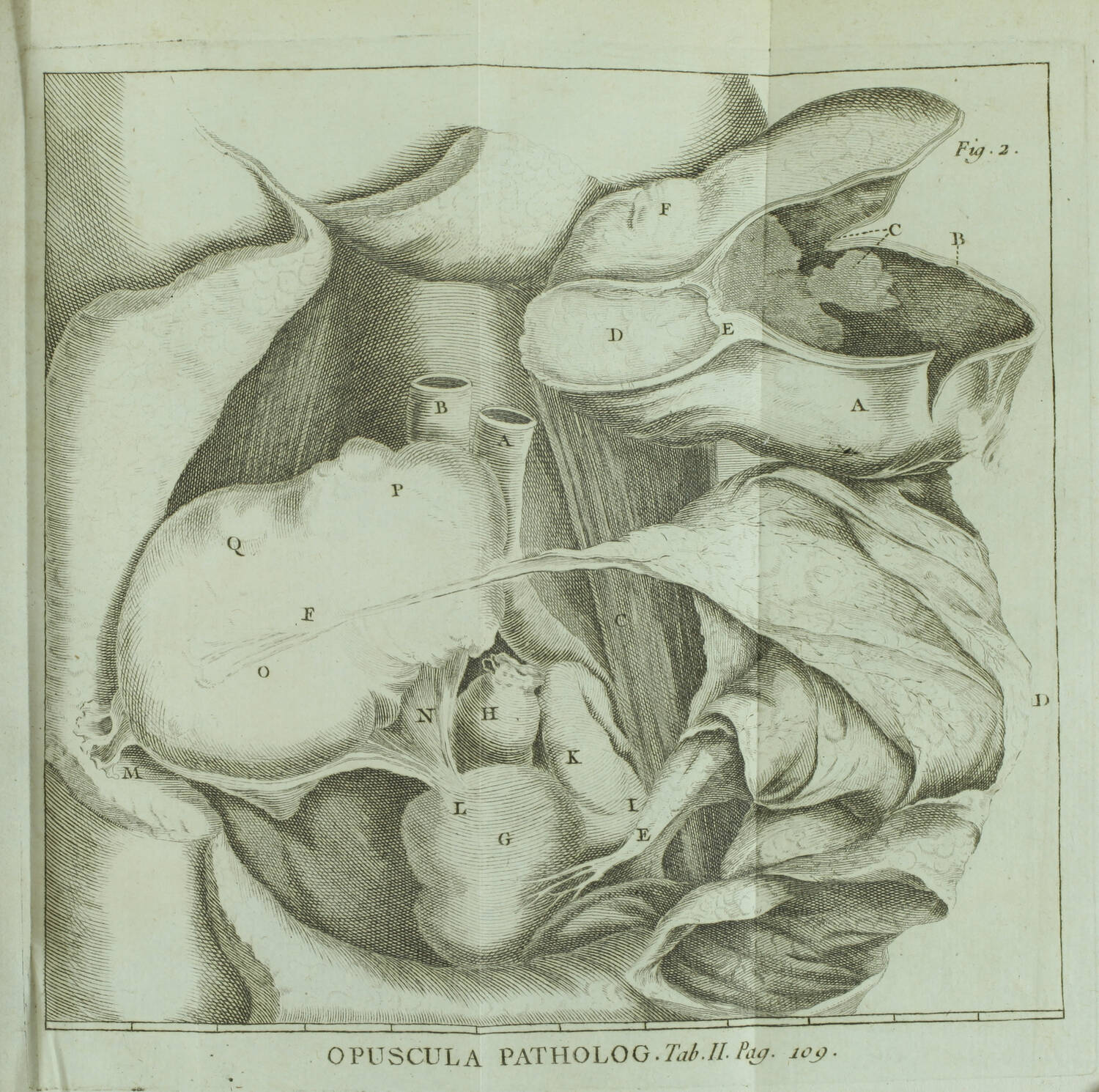 HALLER Opuscula Pathologica - Lausanne, 1755 - EO - Planches - Photo 4, livre ancien du XVIIIe siècle