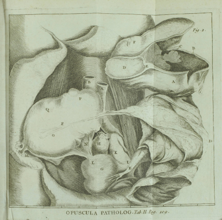 HALLER Opuscula Pathologica - Lausanne, 1755 - EO - Planches - Photo 4, livre ancien du XVIIIe siècle