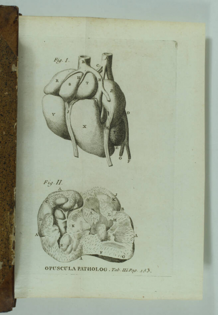 HALLER Opuscula Pathologica - Lausanne, 1755 - EO - Planches - Photo 5, livre ancien du XVIIIe siècle