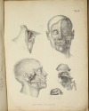 TIEDEMANN - Tabulae arteriarum - 1822 - In plano - Planches - Lithographies - Photo 13, livre rare du XIXe siècle