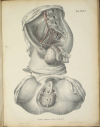 TIEDEMANN - Tabulae arteriarum - 1822 - In plano - Planches - Lithographies - Photo 14, livre rare du XIXe siècle