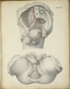 TIEDEMANN - Tabulae arteriarum - 1822 - In plano - Planches - Lithographies - Photo 15, livre rare du XIXe siècle