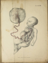 TIEDEMANN - Tabulae arteriarum - 1822 - In plano - Planches - Lithographies - Photo 17, livre rare du XIXe siècle