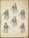 TIEDEMANN - Tabulae arteriarum - 1822 - In plano - Planches - Lithographies - Photo 4, livre rare du XIXe siècle